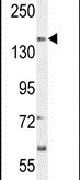 SOGA1 Antibody in Western Blot (WB)