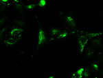 CTAG1B Antibody in Immunocytochemistry (ICC/IF)