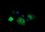 CTAG1B Antibody in Immunocytochemistry (ICC/IF)
