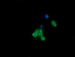 CTAG1B Antibody in Immunocytochemistry (ICC/IF)