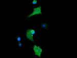 CTAG1B Antibody in Immunocytochemistry (ICC/IF)
