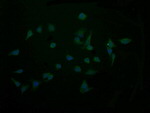 CTAG1B Antibody in Immunocytochemistry (ICC/IF)