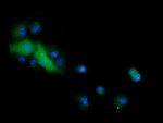 CTAG1B Antibody in Immunocytochemistry (ICC/IF)