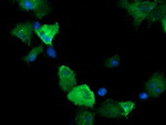 CTAG1B Antibody in Immunocytochemistry (ICC/IF)