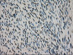 CTAG1B Antibody in Immunohistochemistry (Paraffin) (IHC (P))