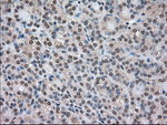 CTAG1B Antibody in Immunohistochemistry (Paraffin) (IHC (P))