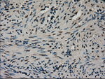 CTAG1B Antibody in Immunohistochemistry (Paraffin) (IHC (P))