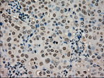 CTAG1B Antibody in Immunohistochemistry (Paraffin) (IHC (P))