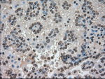 CTAG1B Antibody in Immunohistochemistry (Paraffin) (IHC (P))