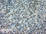 CTAG1B Antibody in Immunohistochemistry (Paraffin) (IHC (P))