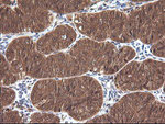 CTAG1B Antibody in Immunohistochemistry (Paraffin) (IHC (P))