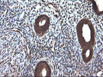 CTAG1B Antibody in Immunohistochemistry (Paraffin) (IHC (P))