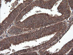 CTAG1B Antibody in Immunohistochemistry (Paraffin) (IHC (P))