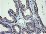 CTAG1B Antibody in Immunohistochemistry (Paraffin) (IHC (P))