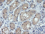 CTAG1B Antibody in Immunohistochemistry (Paraffin) (IHC (P))