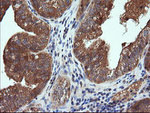 CTAG1B Antibody in Immunohistochemistry (Paraffin) (IHC (P))