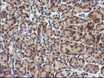 CTAG1B Antibody in Immunohistochemistry (Paraffin) (IHC (P))