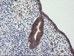 CTAG1B Antibody in Immunohistochemistry (Paraffin) (IHC (P))