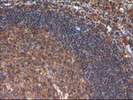 CTAG1B Antibody in Immunohistochemistry (Paraffin) (IHC (P))