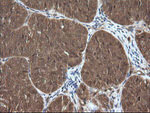CTAG1B Antibody in Immunohistochemistry (Paraffin) (IHC (P))