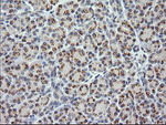 CTAG1B Antibody in Immunohistochemistry (Paraffin) (IHC (P))