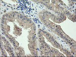 CTAG1B Antibody in Immunohistochemistry (Paraffin) (IHC (P))