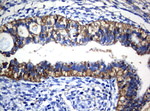 CTAG1B Antibody in Immunohistochemistry (Paraffin) (IHC (P))