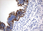 CTAG1B Antibody in Immunohistochemistry (Paraffin) (IHC (P))