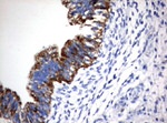 CTAG1B Antibody in Immunohistochemistry (Paraffin) (IHC (P))