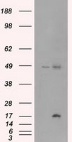 CTAG1B Antibody in Western Blot (WB)
