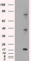CTAG1B Antibody in Western Blot (WB)