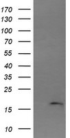 CTAG1B Antibody in Western Blot (WB)