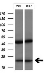 CTAG1B Antibody in Western Blot (WB)