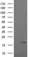 CTAG1B Antibody in Western Blot (WB)