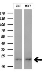 CTAG1B Antibody in Western Blot (WB)