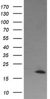 CTAG1B Antibody in Western Blot (WB)
