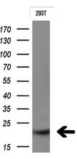 CTAG1B Antibody in Western Blot (WB)