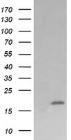 CTAG1B Antibody in Western Blot (WB)