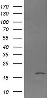 CTAG1B Antibody in Western Blot (WB)