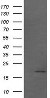 CTAG1B Antibody in Western Blot (WB)