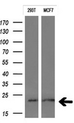CTAG1B Antibody in Western Blot (WB)