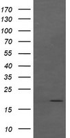 CTAG1B Antibody in Western Blot (WB)