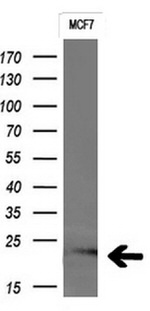 CTAG1B Antibody in Western Blot (WB)