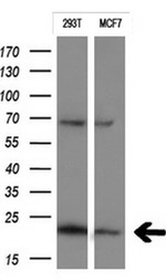 CTAG1B Antibody in Western Blot (WB)