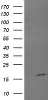 CTAG1B Antibody in Western Blot (WB)