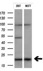 CTAG1B Antibody in Western Blot (WB)