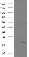 CTAG1B Antibody in Western Blot (WB)