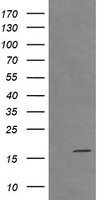 CTAG1B Antibody in Western Blot (WB)