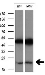 CTAG1B Antibody in Western Blot (WB)