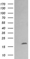 CTAG1B Antibody in Western Blot (WB)